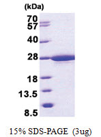 RABL5 (1-185, His-tag) Human Protein