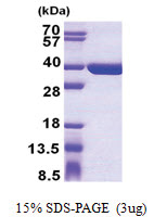 SULT1C4 / SULT1C2 (1-302, His-tag) Human Protein