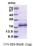 DPH4 (1-149, His-tag) Human Protein
