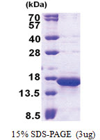 TOMM20 (25-145, His-tag) Human Protein