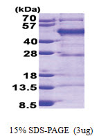 FBLIM1 (1-373, His-tag) Human Protein
