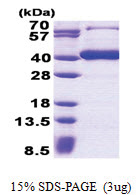 B3GAT3 (29-335, His-tag) Human Protein