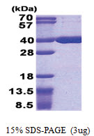 ACOT8 (1-319, His-tag) Human Protein
