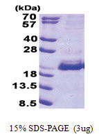 SRP19 (1-144, His-tag) Human Protein