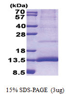 Cystatin-11 (26-103, His-tag) Human Protein