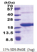 MED21 (1-144, His-tag) Human Protein