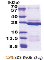FAM50A (150-339, His-tag) Human Protein