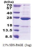 CCDC90B (43-230, His-tag) Human Protein