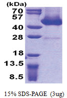 AAGAB (1-315, His-tag) Human Protein