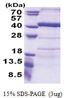 ANKRD54 / LIAR (1-300, His-tag) Human Protein