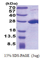 COMMD7 (1-200, His-tag) Human Protein