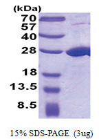 COMMD7 (1-200, His-tag) Human Protein COMMD7 (1-200, His-tag) Human Protein