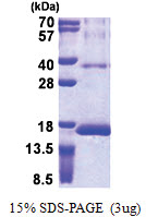 RPS12 (1-132, His-tag) Human Protein RPS12 (1-132, His-tag) Human Protein