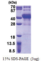 POU6F1 (1-301, His-tag) Human Protein POU6F1 (1-301, His-tag) Human Protein