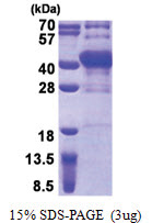 POU6F1 (1-301, His-tag) Human Protein POU6F1 (1-301, His-tag) Human Protein