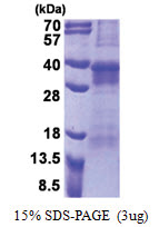 OSCAR (19-286, His-tag) Human Protein OSCAR (19-286, His-tag) Human Protein