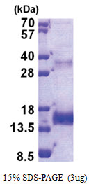 Noelin (34-135, His-tag) Human Protein Noelin (34-135, His-tag) Human Protein