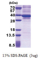 ATP synthase subunit gamma (26-298, His-tag) Human Protein