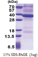 RNASEH2A (1-299, His-tag) Human Protein
