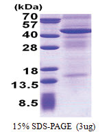 CD213a2 / IL13RA2 (27-343, His-tag) Human Protein