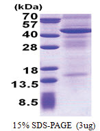CD213a2 / IL13RA2 (27-343, His-tag) Human Protein