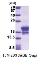 POLE3 (1-147, His-tag) Human Protein