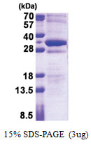Stathmin-4 / STMN4 (1-216, His-tag) Human Protein