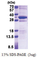 Stathmin-4 / STMN4 (1-216, His-tag) Human Protein