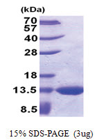 glpE (1-108, His-tag) Escherichia coli Protein