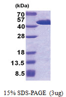 FIBP (1-364, His-tag) Human Protein