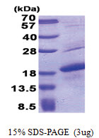 MART-1 (48-118, His-tag) Human Protein