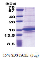 C1D (1-141, His-tag) Human Protein