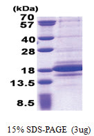 C1D (1-141, His-tag) Human Protein