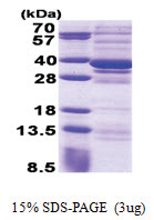 CPPED1 (1-314, His-tag) Human Protein