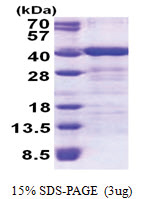 TOMM34 (1-309, His-tag) Human Protein