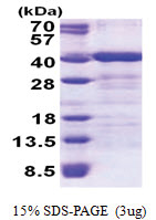TOMM34 (1-309, His-tag) Human Protein
