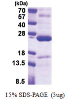 TNFAIP8 (1-198, His-tag) Human Protein