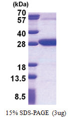 REXO2 (26-237, His-tag) Human Protein