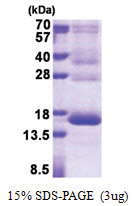 Hemoglobin gamma-1 chain (1-147, His-tag) Human Protein