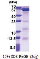 Polycomb protein EED (1-441, His-tag) Human Protein