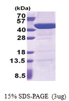 UBXN2B (His-tag) Human Protein