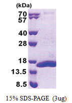 Complex IV subunit Vb (32-129, His-tag) Human Protein