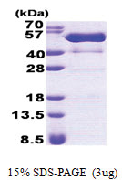 PSTPIP1 / CD2BP1 (1-416, His-tag) Human Protein