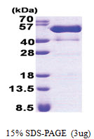 PSTPIP1 / CD2BP1 (1-416, His-tag) Human Protein