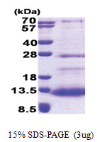 ECRG-2 (20-85, His-tag) Human Protein