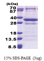 CNOT8 (1-292, His-tag) Human Protein