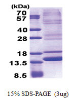 Neuromedin B (25-121, His-tag) Human Protein