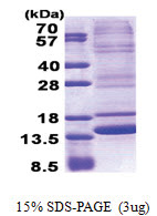 Neuromedin B (25-121, His-tag) Human Protein