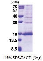 FAM119A (93-218, His-tag) Human Protein