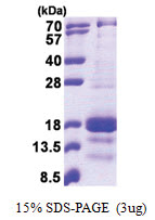 CXCL9 (23-125, His-tag) Human Protein